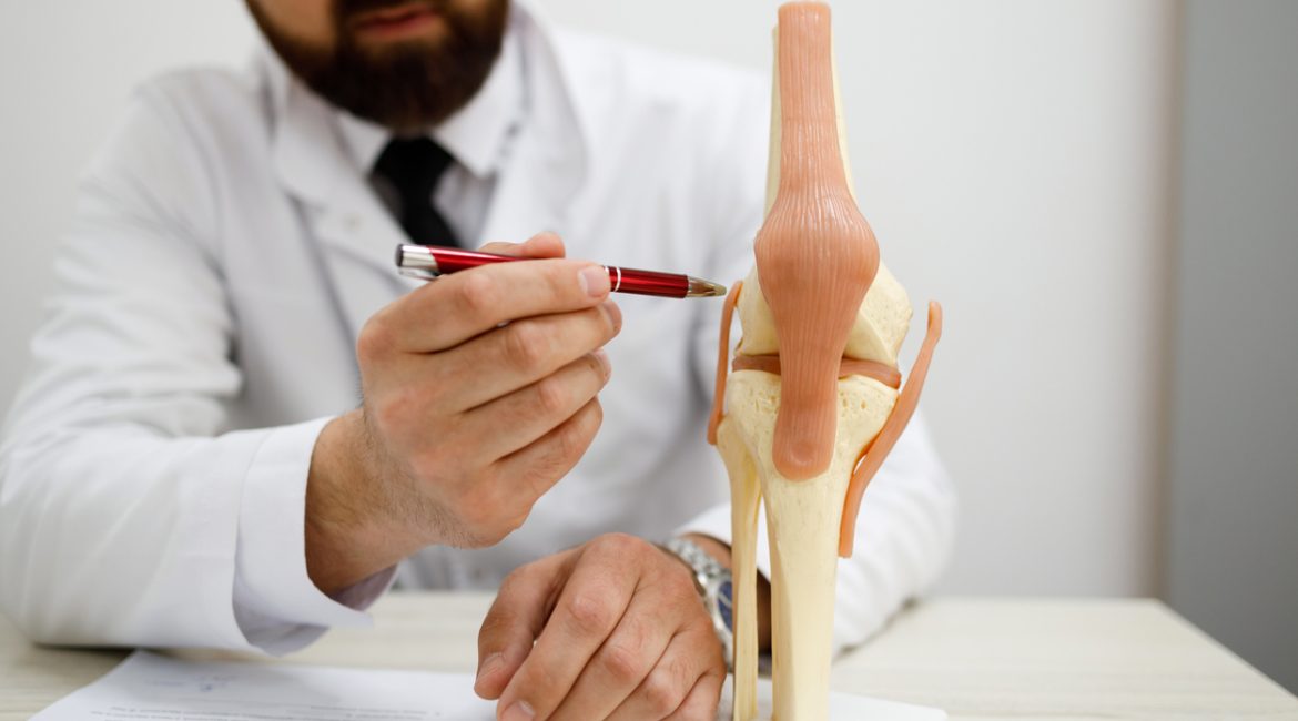 knee replacement